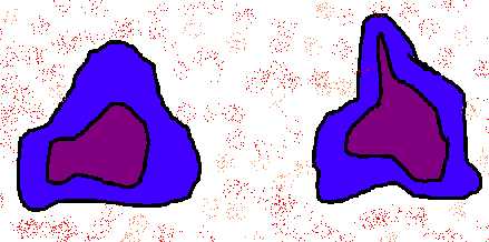globuli_bianchi.jpg (18245 byte)