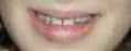 bocca_alessia.jpg (1225 byte)
