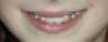bocca_alexia.jpg (1102 byte)