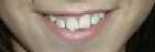 bocca_miriam.jpg (1368 byte)