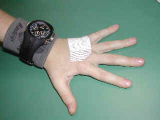 pelle_ferita.jpg (6533 byte)